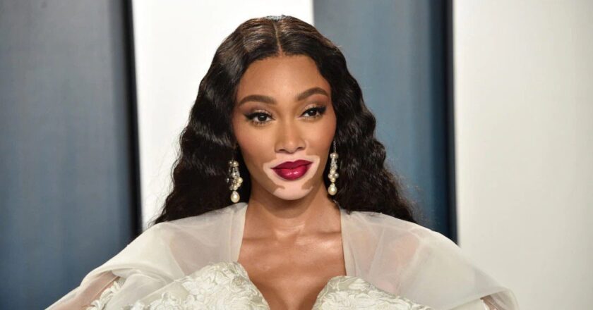 Winnie Harlow Net Worth 2022